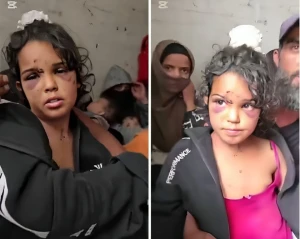«كسروا حوض طفلة واعتدوا على رضيع».. بالفيديو.. «البدو» يروون جرائم ميليشيات حكمت الهجري في السويداء