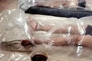 الديدان تخرج من أجسامهم..  بالصور: جزائري يزعم تعرض زوجته وأطفاله  لظاهرة غريبة بسبب أعمال السحر