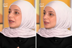هل زراعة الكلى تصلح لكل المرضى؟.. بالفيديو طبيبة تجيب وتكشف عن عوامل تمنع إجراء العملية