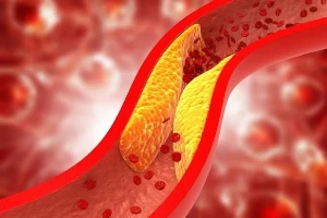 الكشف عن 11 مشروبًا طبيعيًا لخفض الكوليسترول وحماية القلب