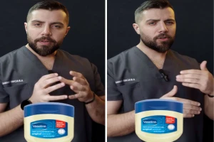 بالفيديو: مختص يكشف ما يحدث للبشرة عند وضع الفازلين عليها يوميًا قبل النوم لمدة أسبوعين