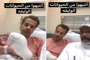 بسبب الغيرة.. بالفيديو: مواطن يروي كيف كاد أن يفقد يده بعد عضة قط غاضب