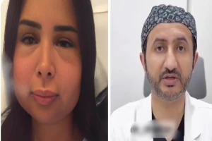 بالفيديو.. أول تعليق  لطبيب استشاري على تورم وانتفاخ وجه المودل دانا الشهري بعد إجرائها عملية تجميل فاشلة