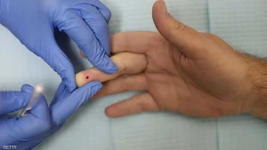 شفاء رجل في النرويج من فيروس الإيدز .. والكشف عن طريقة علاجه