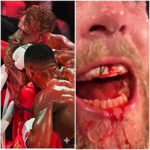 بالفيديو.. كسر فك الملاكم الأمريكي جيك بول ونقله للمستشفى بعد الخسارة أمام "جوشوا" بالضربة القاضية