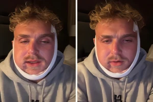 يبكي ووجهه منتفخ.. بالفيديو: أول ظهور للملاكم جيك بول بعد إجرائه عملية جراحية عقب الضربة التي تلقاها من جوشوا