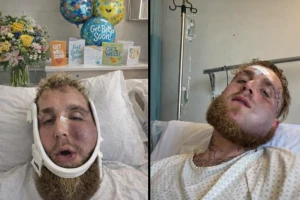 ظهر بوجه متورم.. صورة جديدة للملاكم جيك بول قبل إجرائه عملية جراحية بعد الضربة التي تلقاها من جوشو