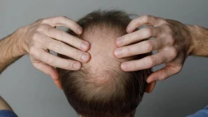 عشبة صينية قديمة تثبت فاعلية كبيرة في مواجهة الصلع.. وهذا ما يحدث لفروة الرأس عند استخدامها!