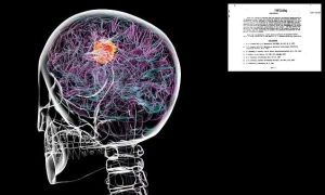 وثيقة سرية أخفتها المخابرات الأمريكية أكثر من 60 عاما تكشف عن علاج محتمل لسرطان الدماغ!