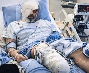 جدل واسع حول صورة  متداولة لـ"مجتبى خامنئي" بقدم مبتورة وعين مصابة