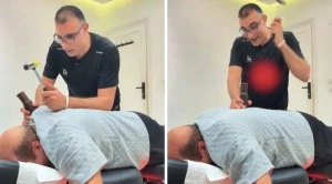 "يا شيخ مريع ليش تصوت فضحتنا بين القبايل".. فيديو طريف للطبيب المصري أبو النصر يعالج مريض سعودي باستخدام المطرقة والأخير يصرخ من الألم