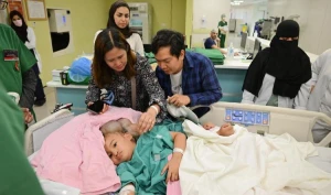 "الربيعة" يكشف تفاصيل عملية فصل التوأم الملتصق الفلبيني "كليا وموريس آن".. ويحدد نسبة الخطر!