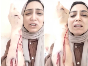 بسبب خلع ضرس .. بالفيديو.. طبيبة أسنان مصرية توثق لحظة الاعتداء عليها داخل مركز طبي في منطقة شبرا