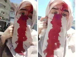 مصر :  بالفيديو.. سيدة منتقبة تكشف تفاصيل إصابتها في واقعة الاعتداء على طبيبة أسنان بشبرا الخيمة