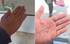 بالفيديو: سبب غريب يدفع طبيباً في مستشفى بالعراق لكتابة الدواء على يد المريض !