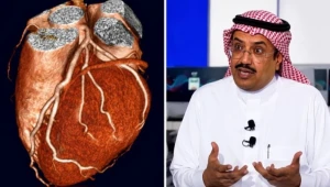 هل الأشعة المقطعية الطبيعية تعني نظافة شرايين القلب 100%؟.. النمر يجيب ويحسم الجدل