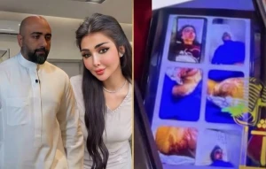 بعد عودته إلى ممارسة عمله.. جدل في العراق بعد إطلاق سراح طبيب تجميل متهم بإحراق زوجته بالزيت المغلي وفقدان إحدى عينيها