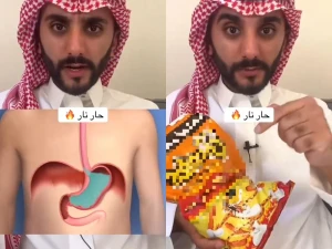 بالفيديو: طبيب يكشف خطر تناول شيبس «حار نار» على المريء والمعدة