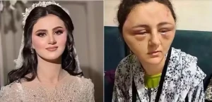 داس على وجهها بقدميه وسحلها من شعرها.. فتاة مصرية تتهم والدها بالاعتداء عليها في القليوبية لسبب غير متوقع