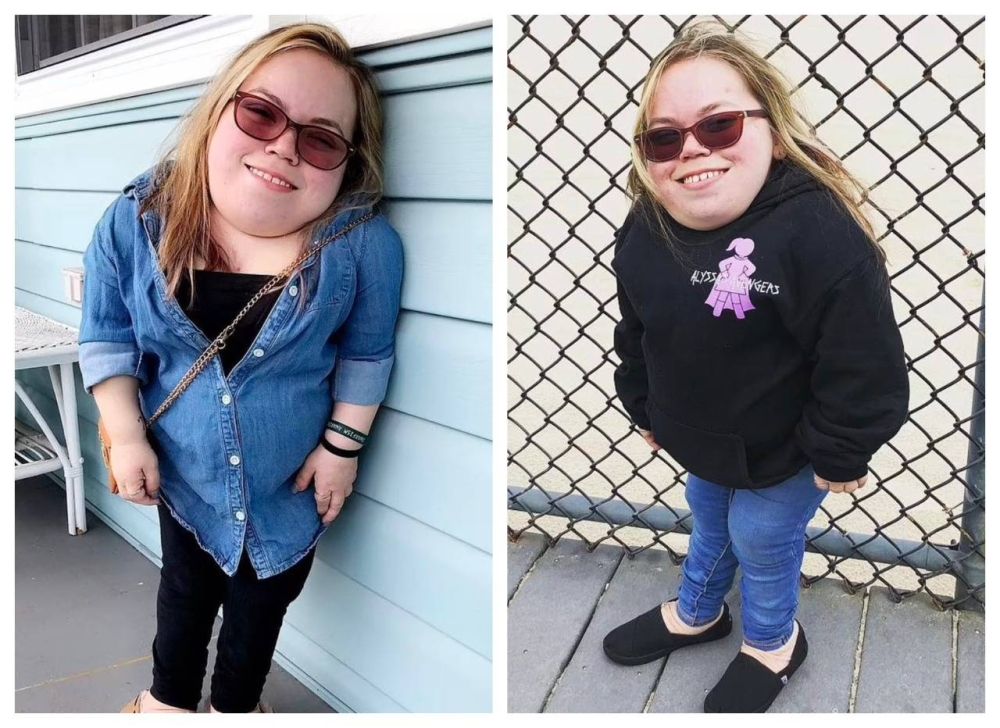 شاهد.. فتاة "قزمة" تعمل كعارضة أزياء وتبحث عن فارس أحلامها