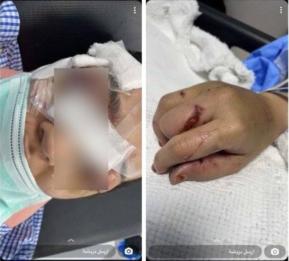 بيان من النيابة العامة بشأن اعتداء  شخص على زوجته وضربها بآلة حادة بجدة