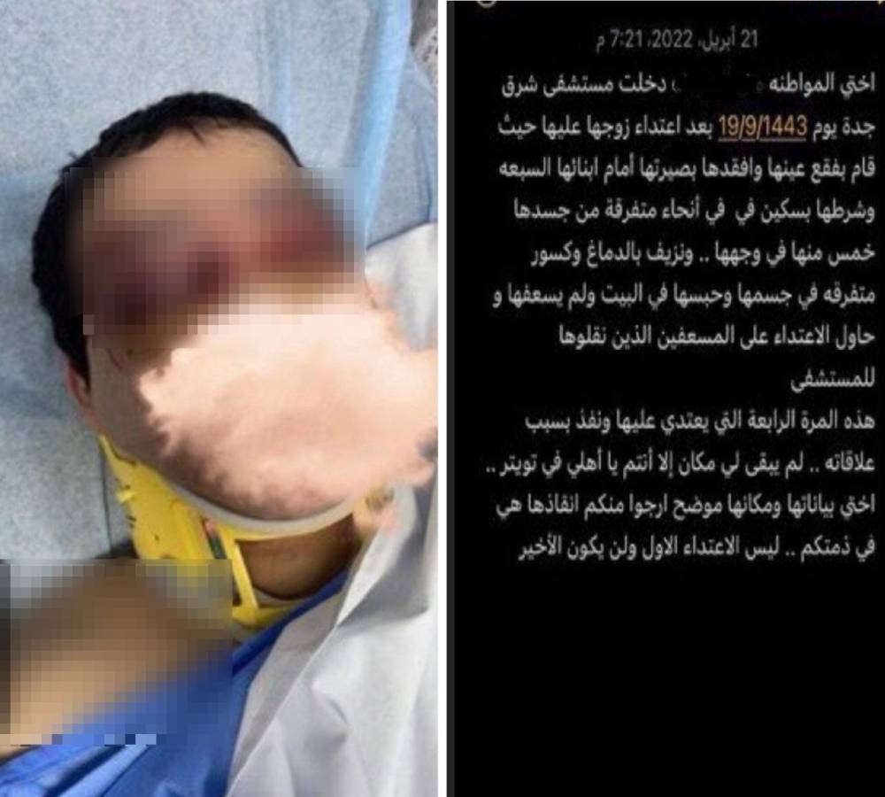 "فقأ عينها وحاول الاعتداء على المسعفين" .. شقيقة معنفة جدة تكشف تفاصيل صادمة عن تعذيبها على يد زوجها أمام أبنائها السبعة