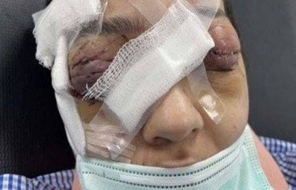 "لو تنازلت ابنتي سأقتل نفسي".. والدة معنفة جدة : زوجها ضربها بمقبض الرشاش بين عينيها وحلق شعرها وحاول التستر على فعلته