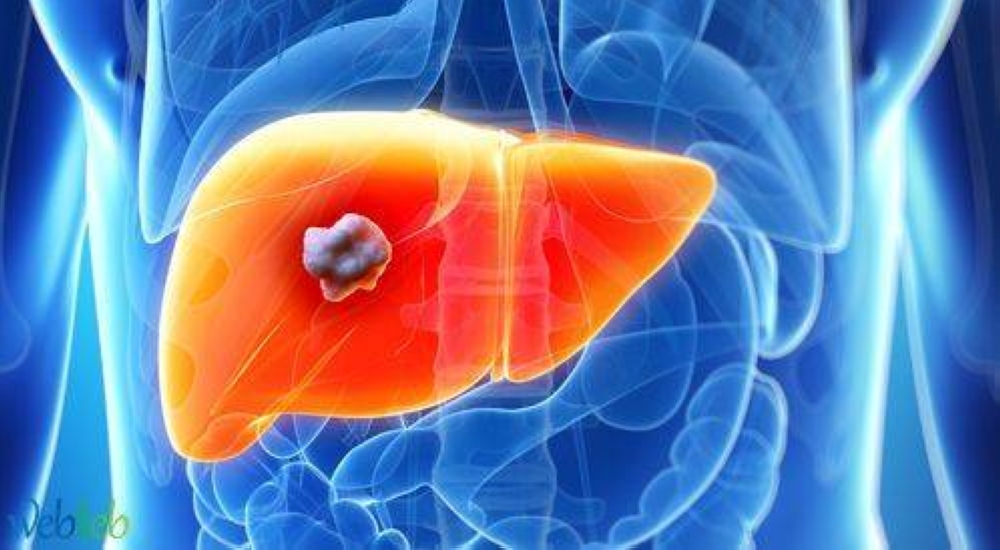 "بعد علاجهم بالتكميم"...استشاري سعودي يكشف ماذا حدث لمن يعاني من مرض التهاب وتليف الكبد