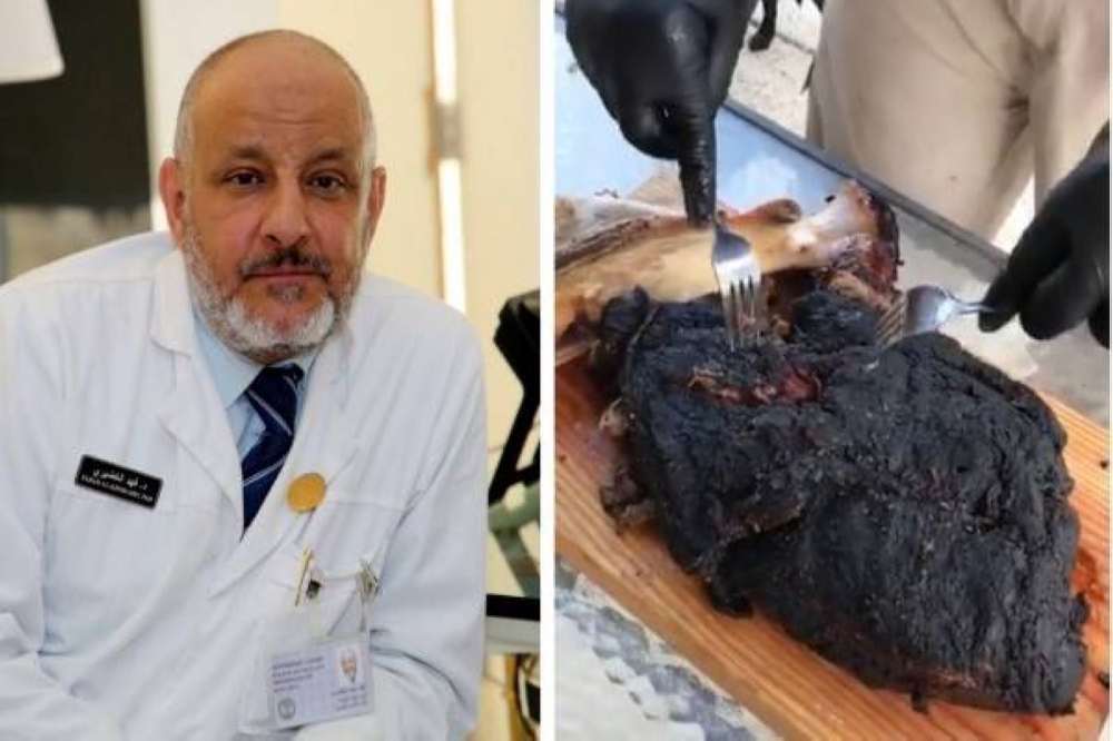 هل الأسطح المحترقة من المشويات واللحوم تُسبب السرطان؟.. الخضيري يجيب