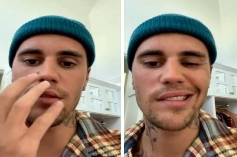 يؤثر على أعصاب أذنه ووجهه.. شاهد: جاستن بيبر يعلن إصابته بمرض خطير