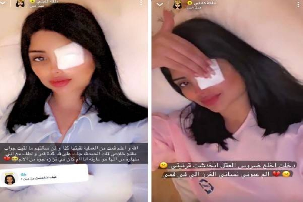 شاهد: أحدث ظهور لملكة كابلي بـ "الضمادة" على إحدى عينيها وتكشف السبب