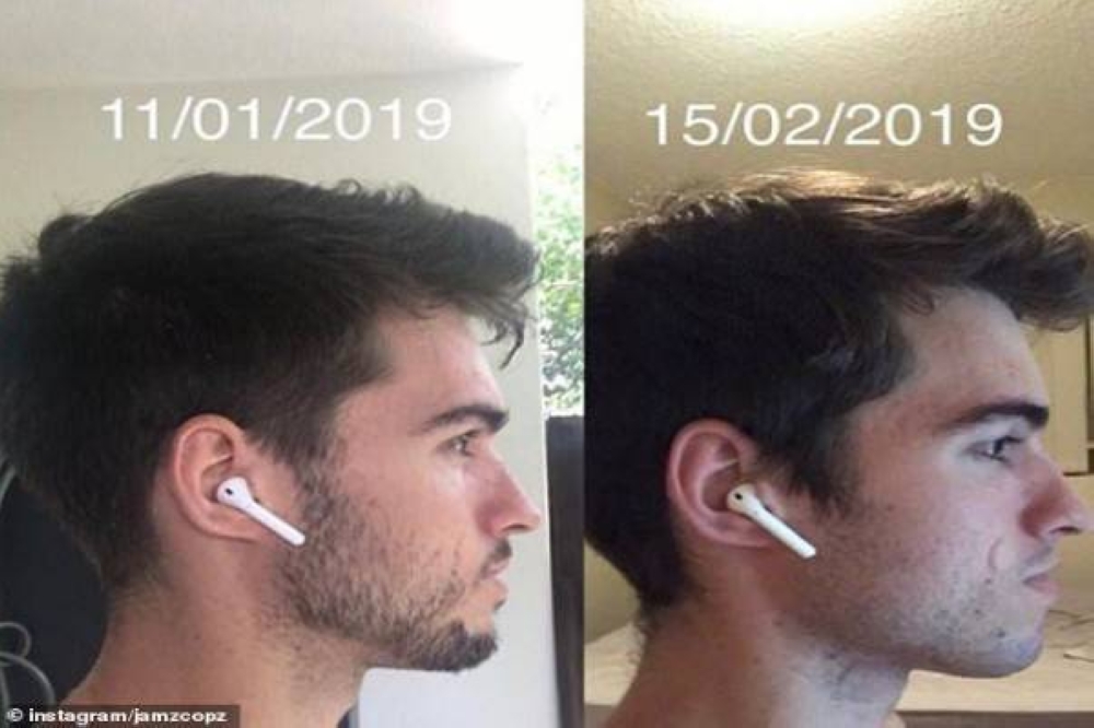 بواسطة اللسان.. شاهد: تمرين بسيط يغير شكل الفك لتبدو أكثر وسامة دون جراحة