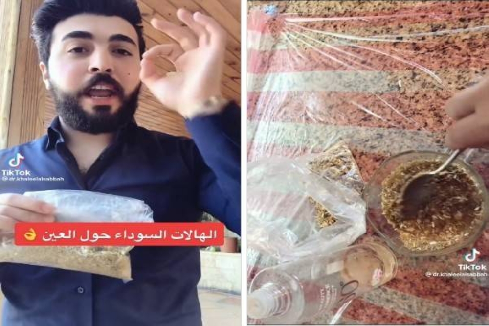 شاهد.. طبيب يكشف عن ماسك طبيعي للتخلص من الهالات السوداء حول العين