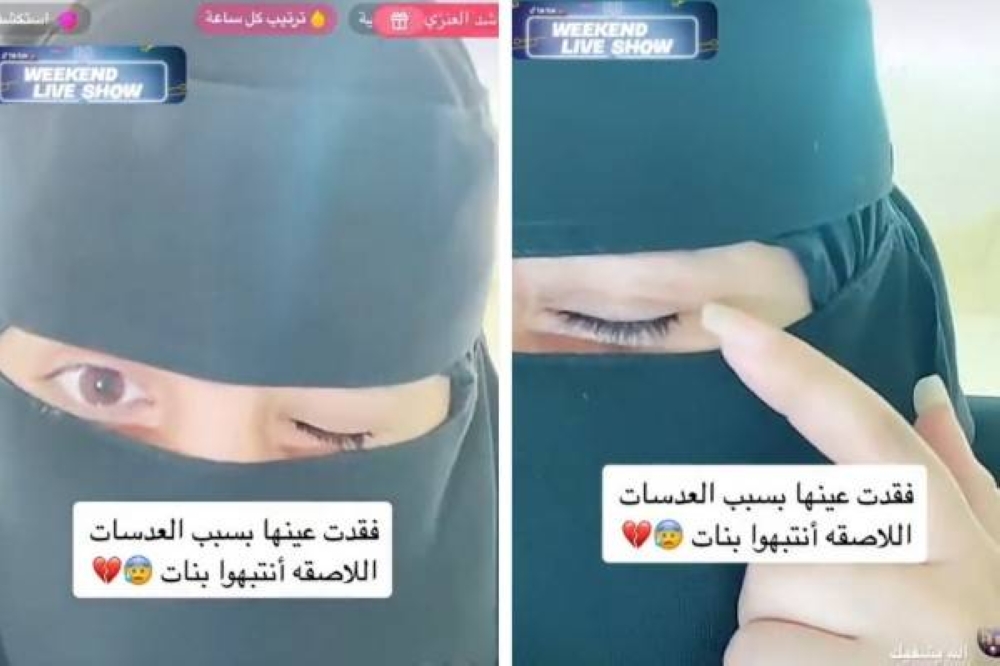 شاهد.. فتاة تكشف كيف تسببت العدسات اللاصقة في فقدان إحدى عينيها