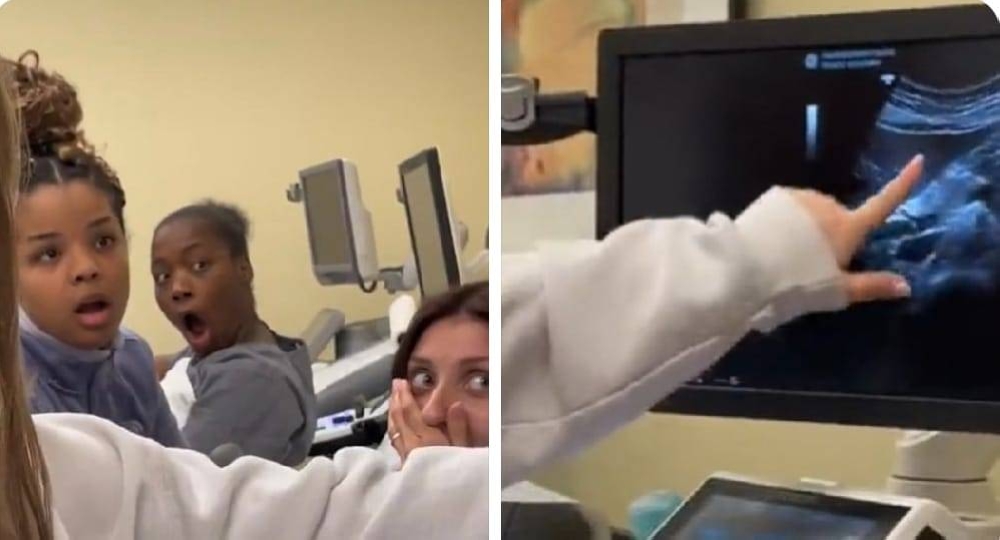 شاهد.. ردة فعل ممرضات اكتشفن بالصدفة أن زميلتهن حامل أثناء التدريب