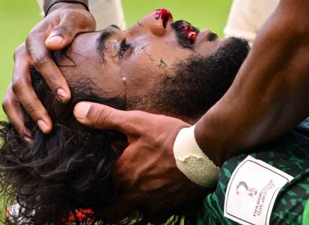 رئيس الهلال  يكشف آخر تطورات الحالة الصحية لـ"ياسر الشهراني" بعد الإصابة القوية في مباراة الأرجنتين