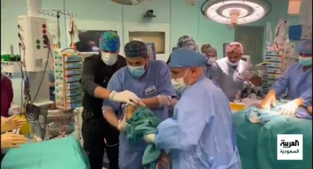 شاهد .. لحظة حمل  أحد التوأم السيامي العراقي بعد فصله عن شقيقه وسط تصفيق الفريق الطبي