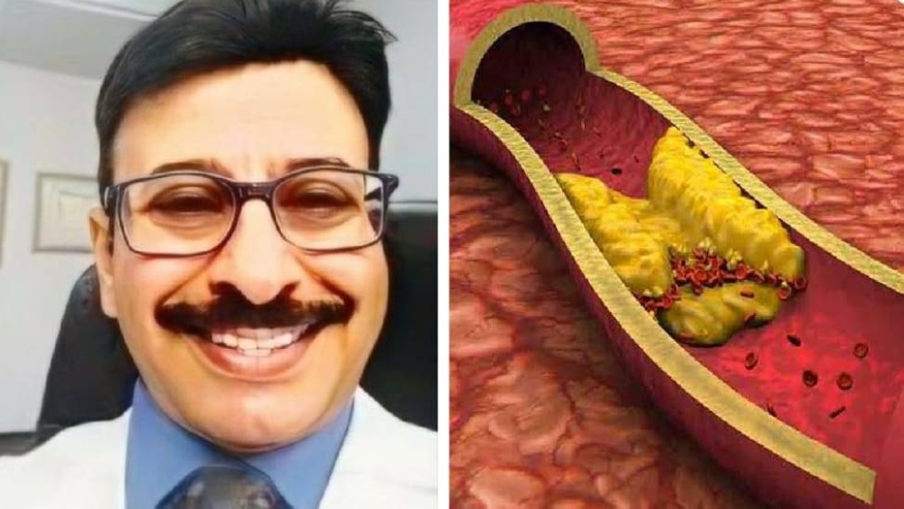 "طبيب" يكشف عن 3 أدوية جديدة لعلاج الدهون وخفض الكوليسترول