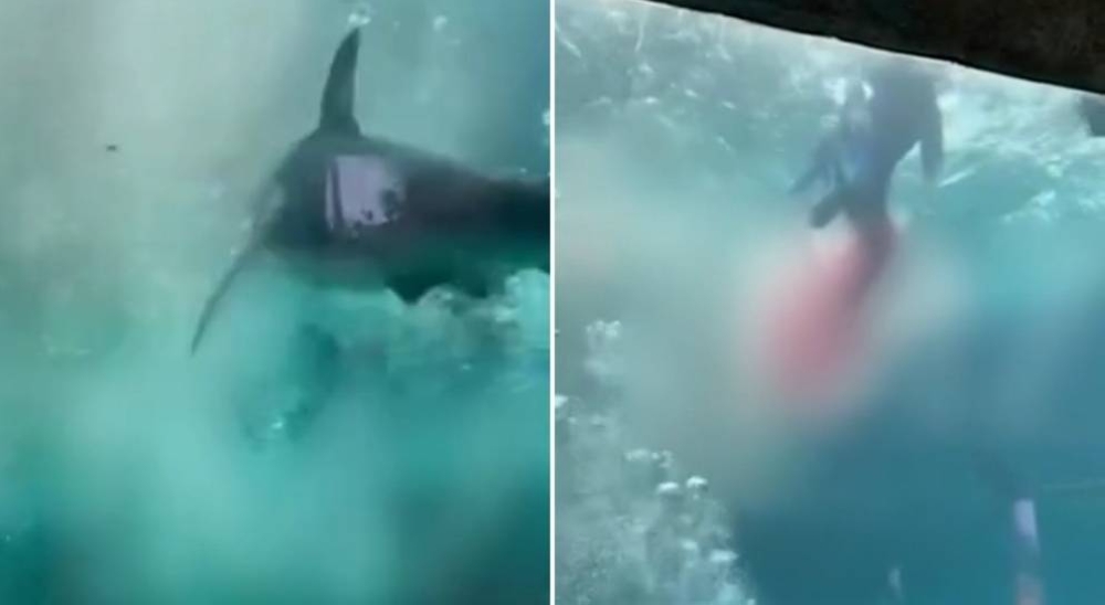 شاهد.. سمكة قرش تهاجم طفل وتقضم ساقه بجزيرة أمريكية