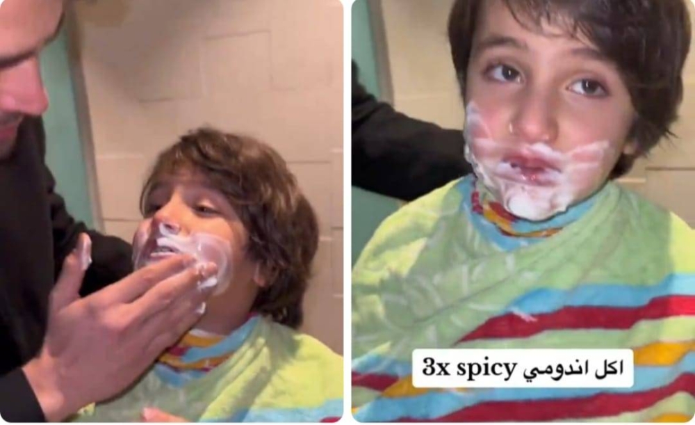 شاهد.. ماذا حدث ل "طفل" بعد تناوله وجبة إندومي حار