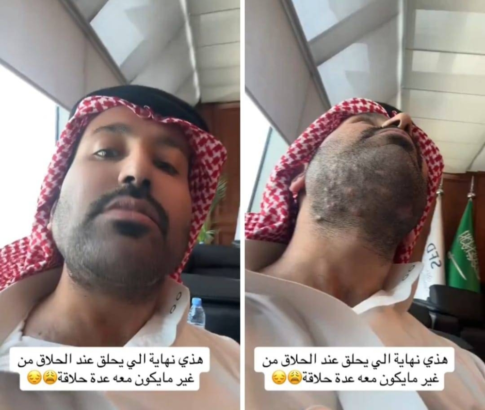 شاهد.. شاب يكشف ما حدث له بعد خروجه من  محل للحلاقة!