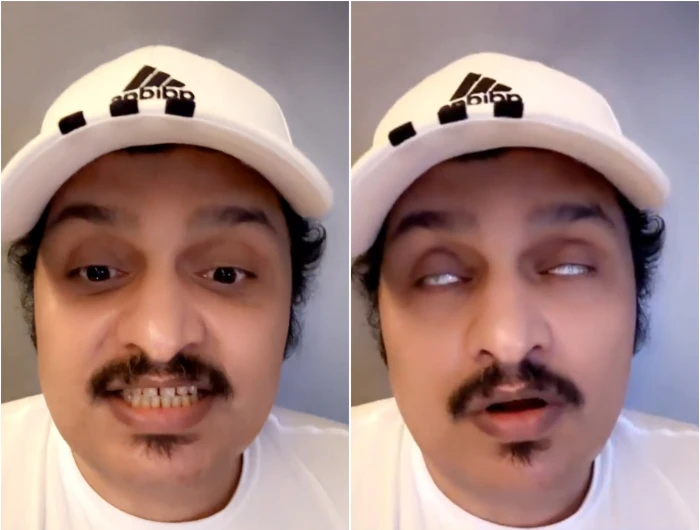 سموني الكبش الوسيم.. بالفيديو: الصبحان يكشف توقعه لنتيجة مباراة " الهلال وباتشوكا" في كأس العالم للأندية