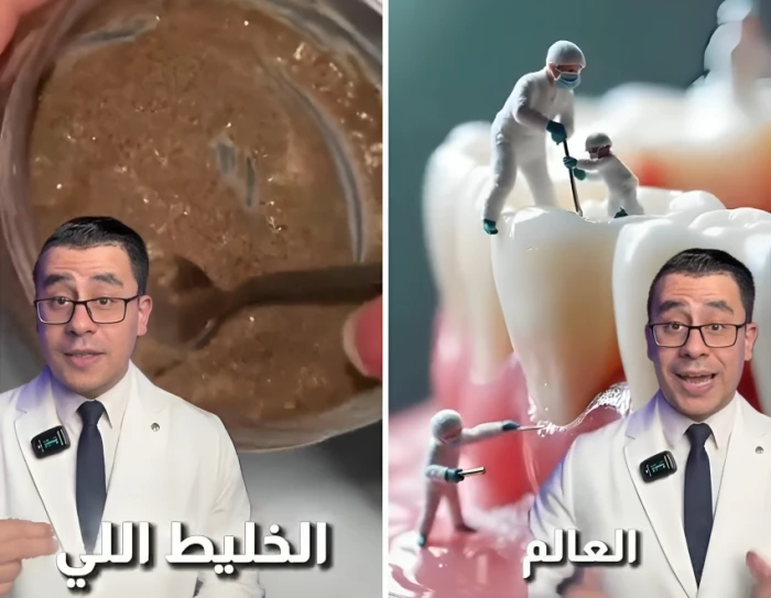 بالفيديو.. طبيب مصري يكشف عن أسهل طريقة لتبييض الأسنان في المنزل