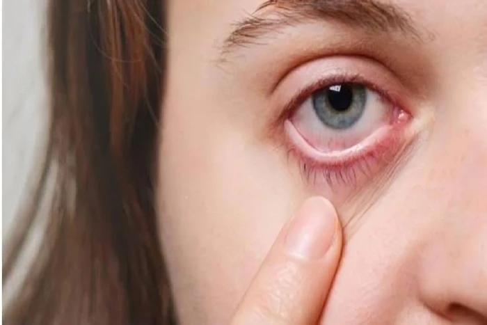 لا تتجاهلها.. 7 أعراض تدل على الإصابة بسرطان العين