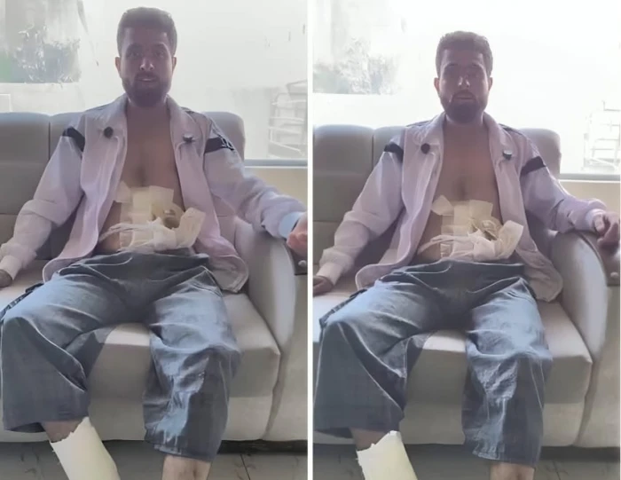 «قتلوا الرجال وأسروا النساء».. بالفيديو.. "شاب مصاب" يكشف جرائم ميليشيا حكمت الهجري ضد أهالي السويداء