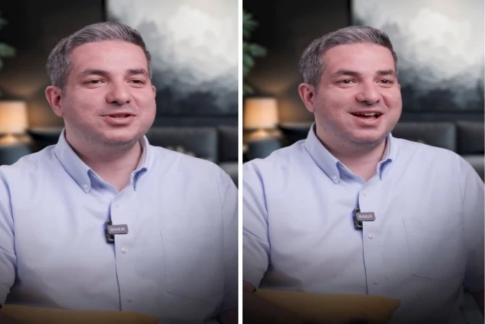 بالفيديو: طبيب يكشف عن مشروب في الصباح يحافظ  على شباب البشرة دون الحاجة إلى البوتكس أو الفيلر