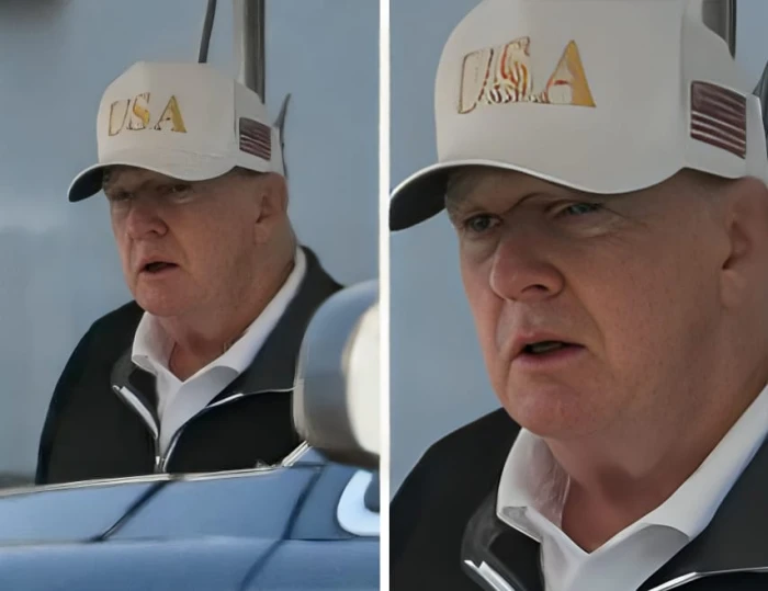 بعد التكهنات حول صحته.. صورة مقربة "لترامب " تظهر انتفاخ غريب على جبينه أخفاه بقبعته