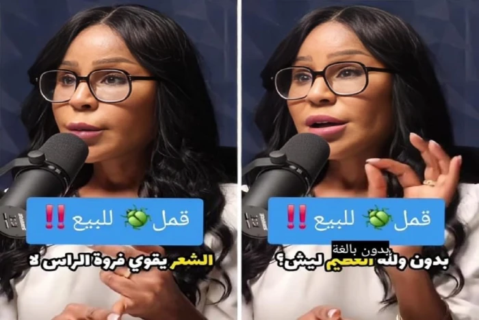 بالفيديو.. طبيبة كويتية تكشف عن ظاهرة غريبة لبيع القمل بـ "5 دنانير" وتوضح السبب