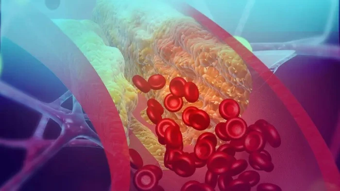 من بينها الحلبة.. 5 أطعمة تنظف الشرايين وتحسن الدورة الدموية