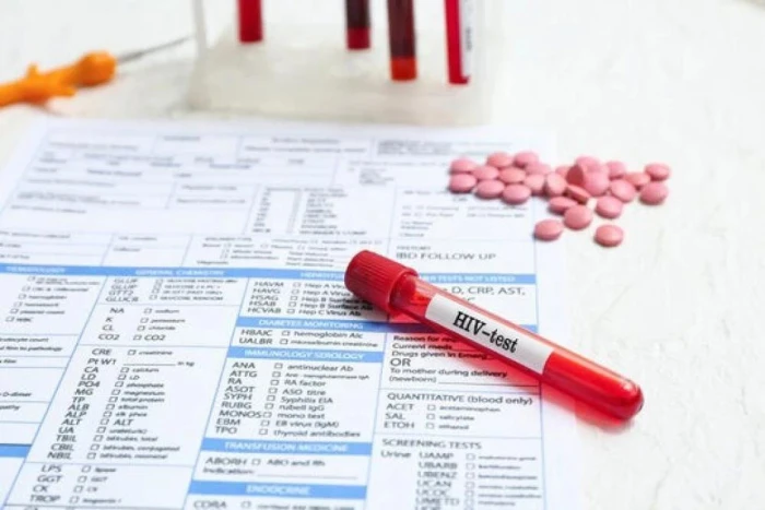 الإعلان عن أول لقاح يمنع الإصابة بفيروس الإيدز  100%